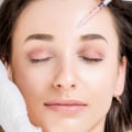 Can Botox Cause Headaches? - An Expert's Perspective