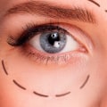 Will Botox Help Sagging Eyelids?