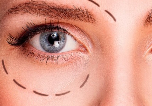 Will Botox Help Sagging Eyelids?